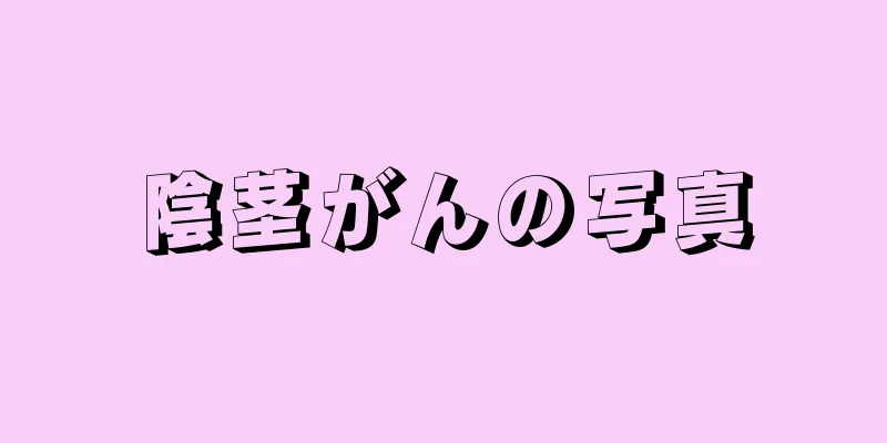 陰茎がんの写真