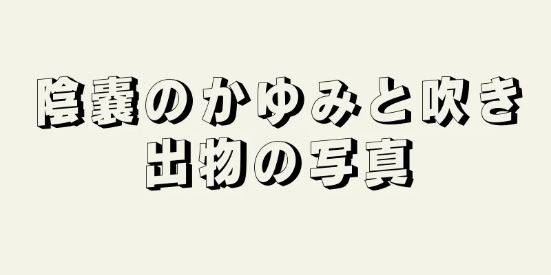 陰嚢のかゆみと吹き出物の写真