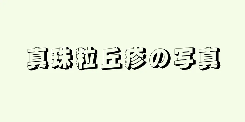 真珠粒丘疹の写真