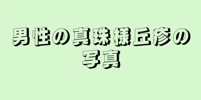 男性の真珠様丘疹の写真