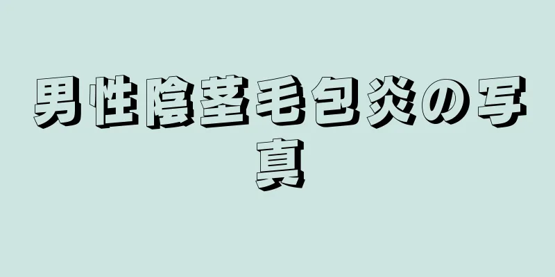 男性陰茎毛包炎の写真