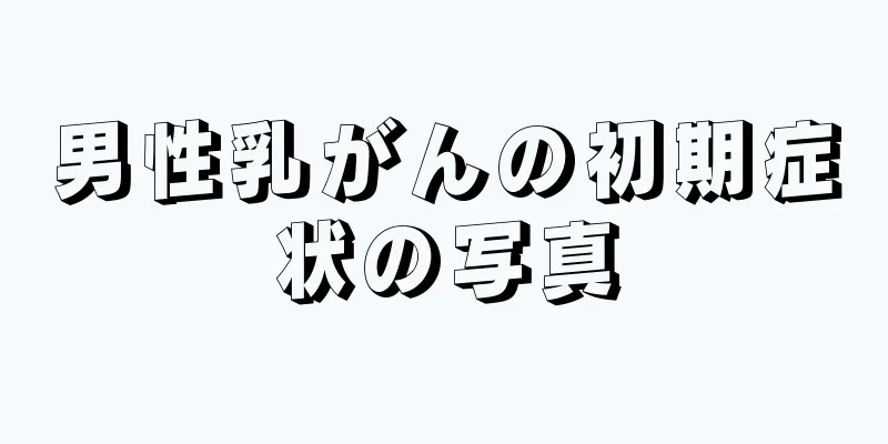 男性乳がんの初期症状の写真
