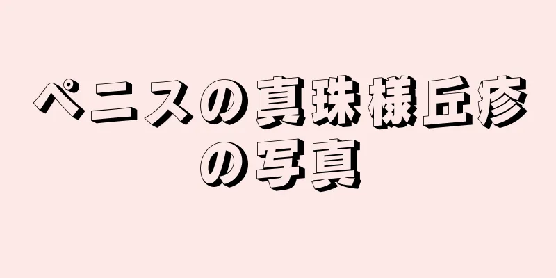 ペニスの真珠様丘疹の写真