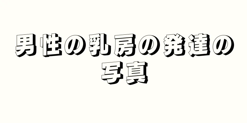 男性の乳房の発達の写真