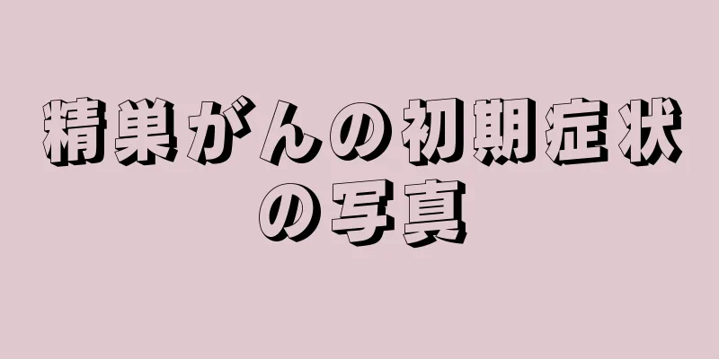 精巣がんの初期症状の写真