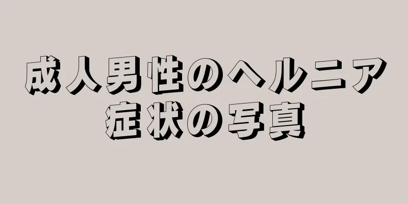 成人男性のヘルニア症状の写真