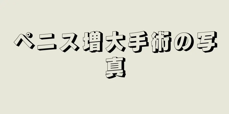 ペニス増大手術の写真