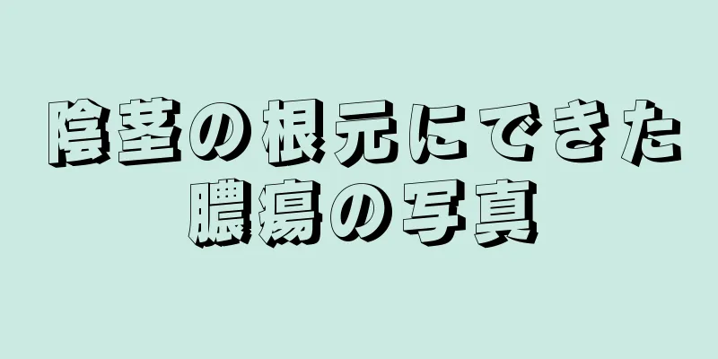 陰茎の根元にできた膿瘍の写真