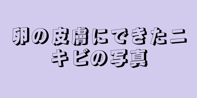 卵の皮膚にできたニキビの写真