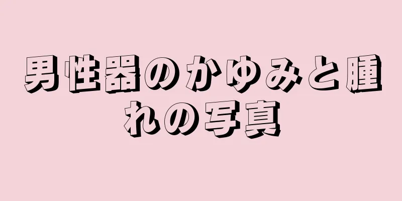 男性器のかゆみと腫れの写真