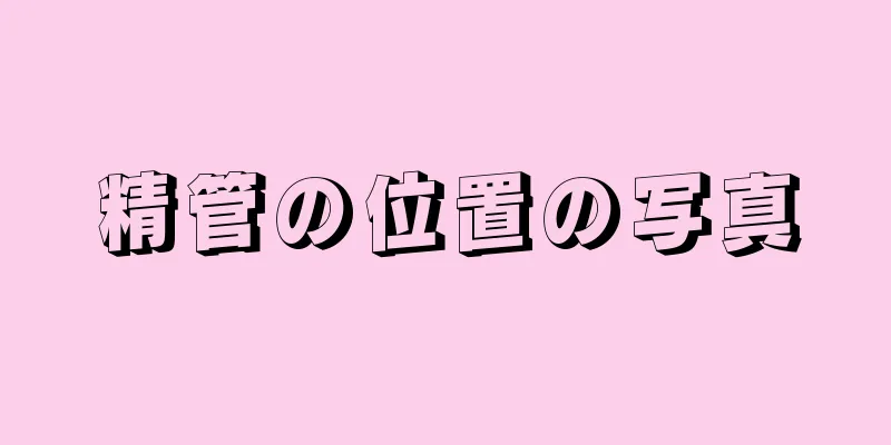 精管の位置の写真