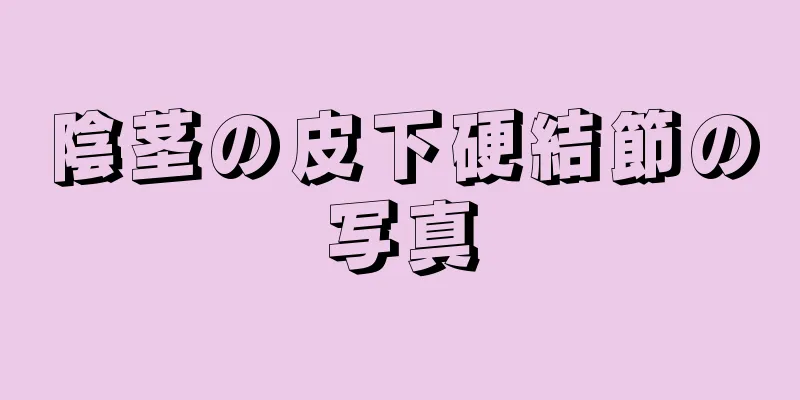 陰茎の皮下硬結節の写真