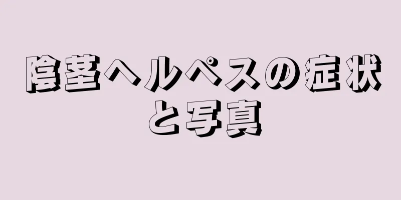 陰茎ヘルペスの症状と写真