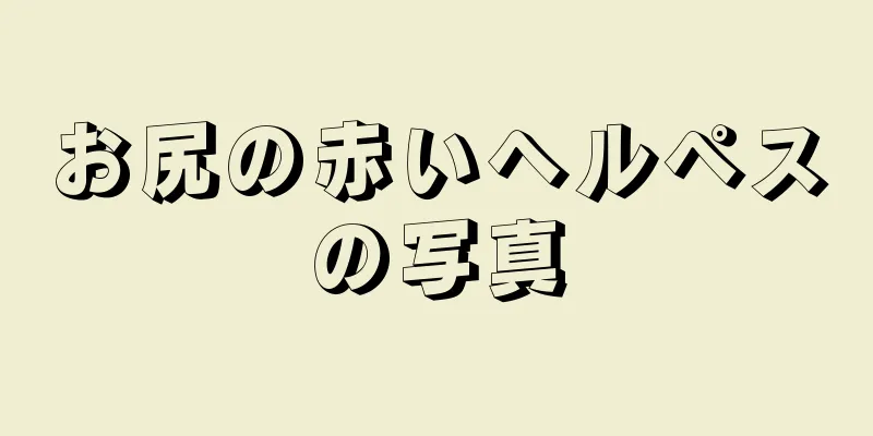 お尻の赤いヘルペスの写真