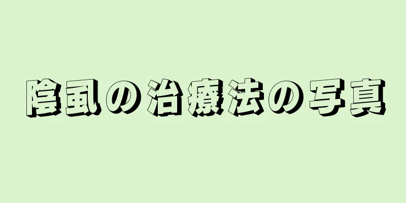 陰虱の治療法の写真