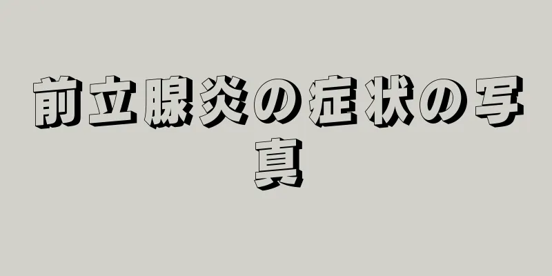 前立腺炎の症状の写真