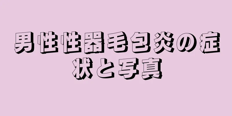 男性性器毛包炎の症状と写真