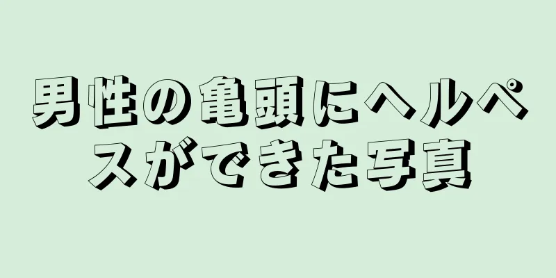 男性の亀頭にヘルペスができた写真