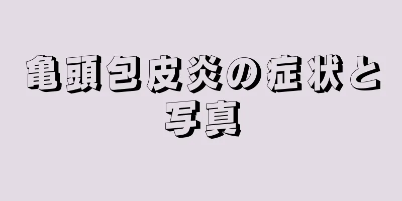亀頭包皮炎の症状と写真