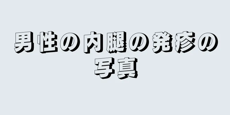 男性の内腿の発疹の写真