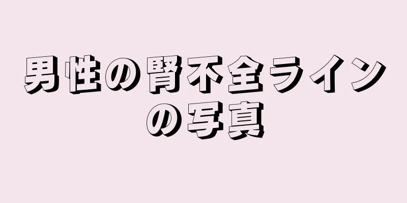 男性の腎不全ラインの写真