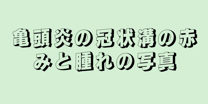 亀頭炎の冠状溝の赤みと腫れの写真