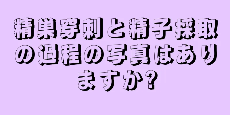 精巣穿刺と精子採取の過程の写真はありますか?