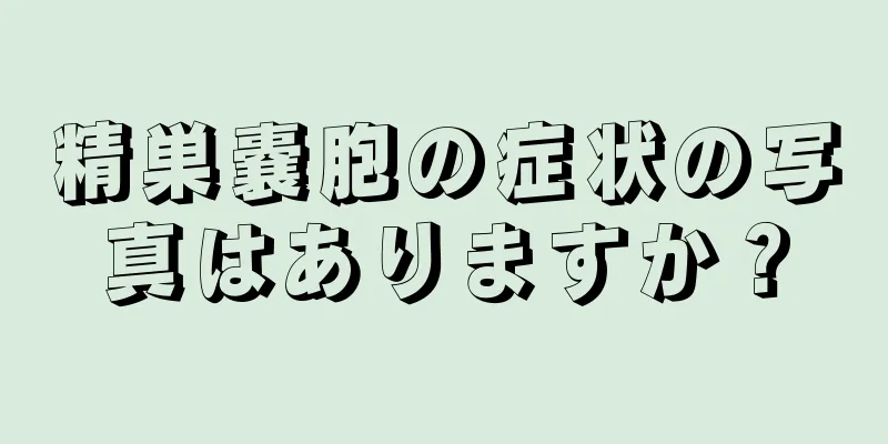 精巣嚢胞の症状の写真はありますか？