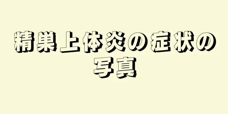 精巣上体炎の症状の写真