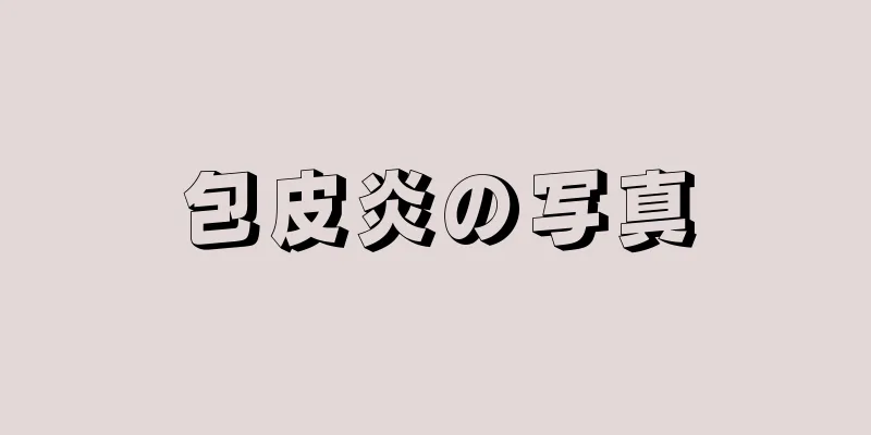 包皮炎の写真