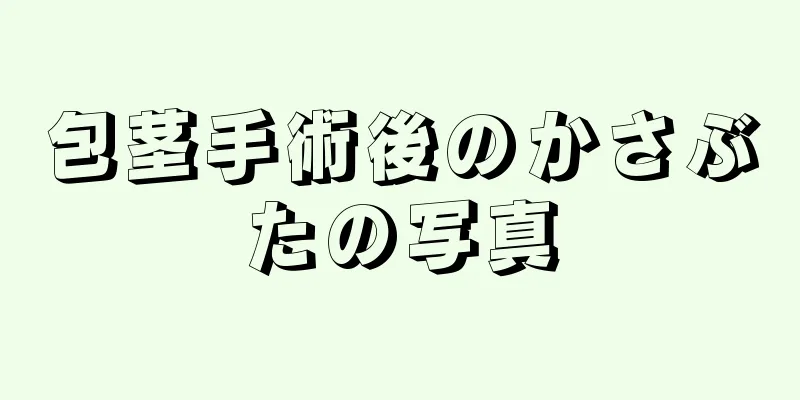 包茎手術後のかさぶたの写真