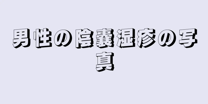 男性の陰嚢湿疹の写真