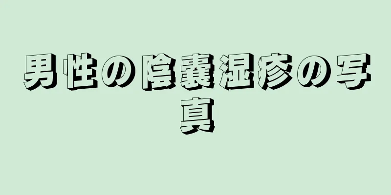 男性の陰嚢湿疹の写真