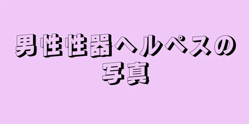 男性性器ヘルペスの写真