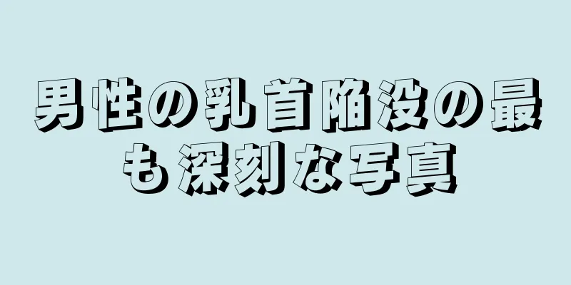 男性の乳首陥没の最も深刻な写真