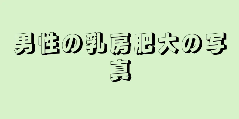 男性の乳房肥大の写真