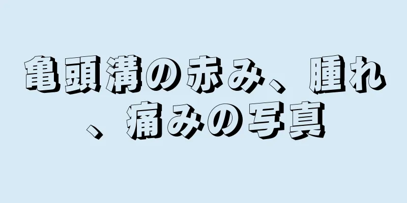 亀頭溝の赤み、腫れ、痛みの写真