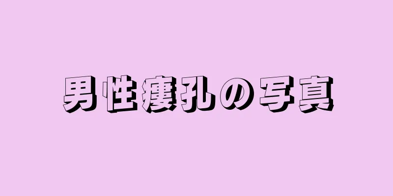 男性瘻孔の写真