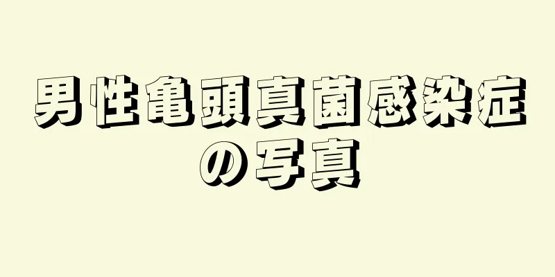 男性亀頭真菌感染症の写真
