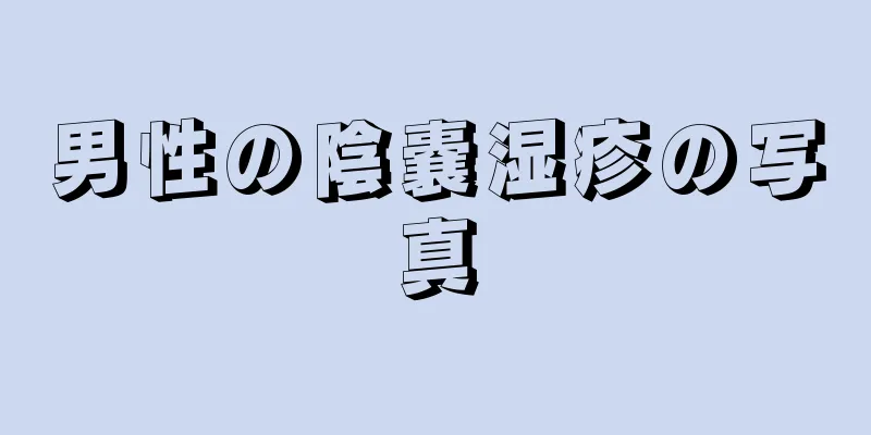 男性の陰嚢湿疹の写真