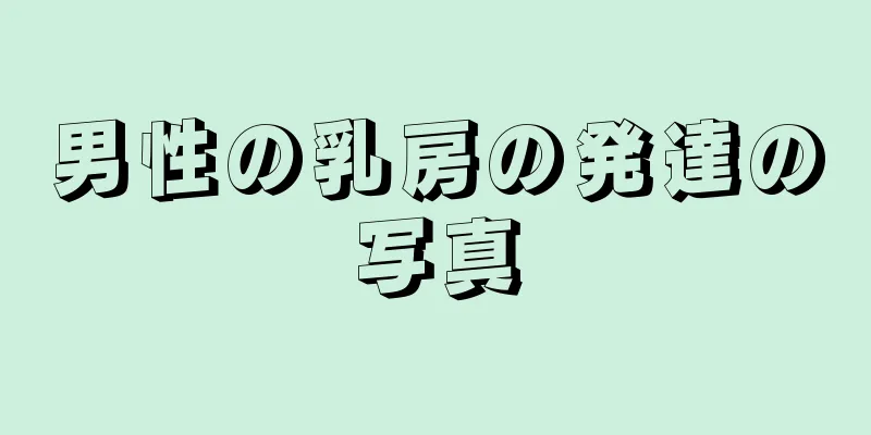 男性の乳房の発達の写真