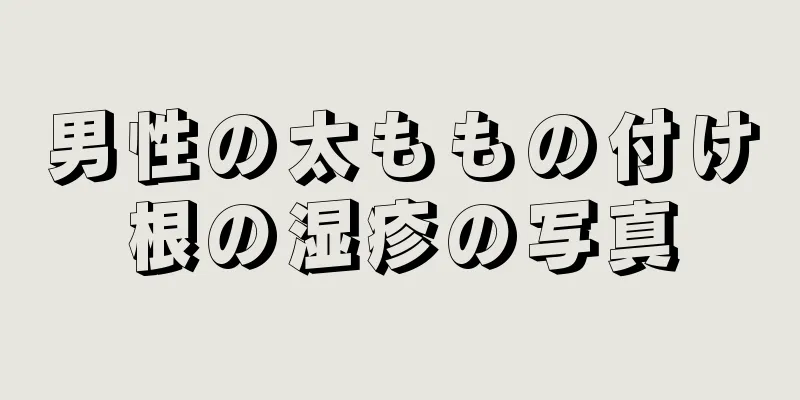 男性の太ももの付け根の湿疹の写真
