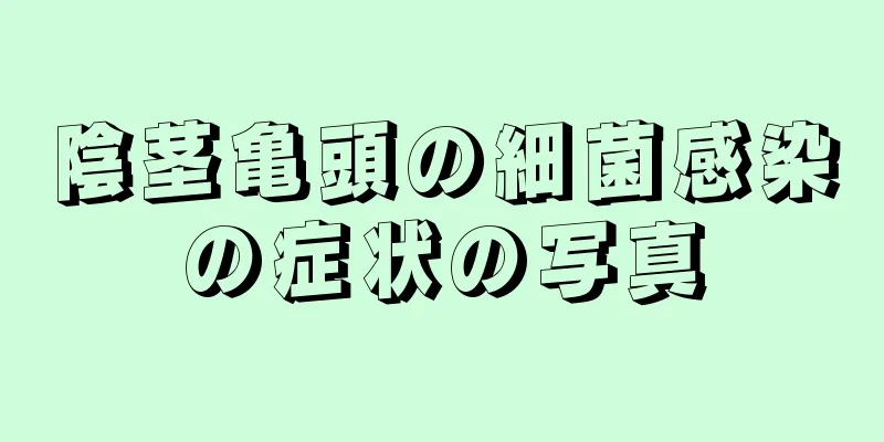 陰茎亀頭の細菌感染の症状の写真