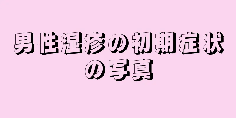 男性湿疹の初期症状の写真