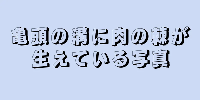 亀頭の溝に肉の棘が生えている写真