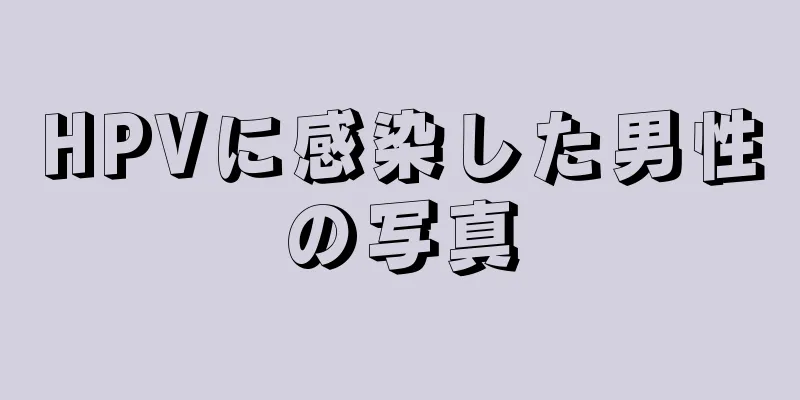 HPVに感染した男性の写真