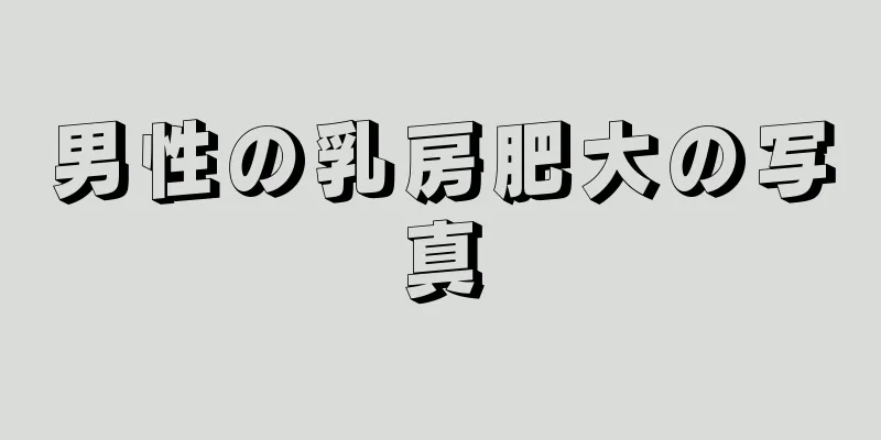 男性の乳房肥大の写真