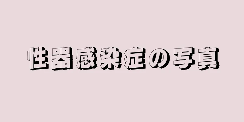 性器感染症の写真