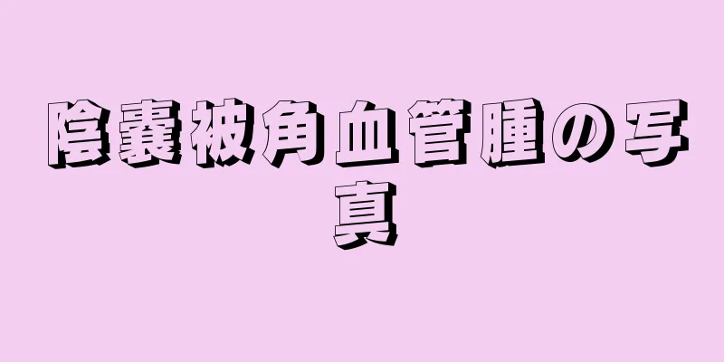 陰嚢被角血管腫の写真