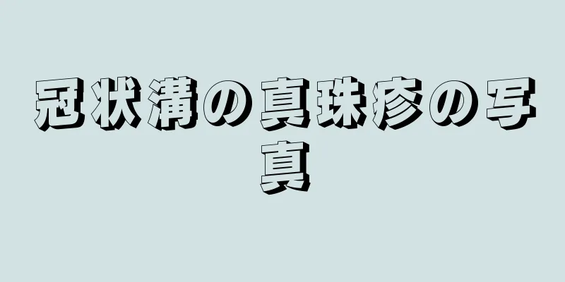 冠状溝の真珠疹の写真